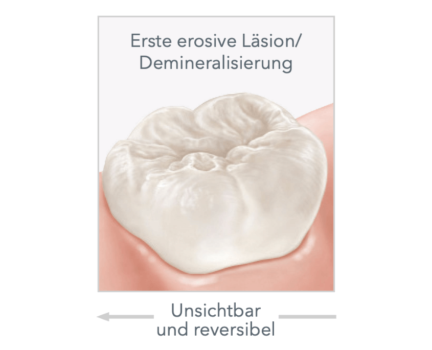Weiße Zähne