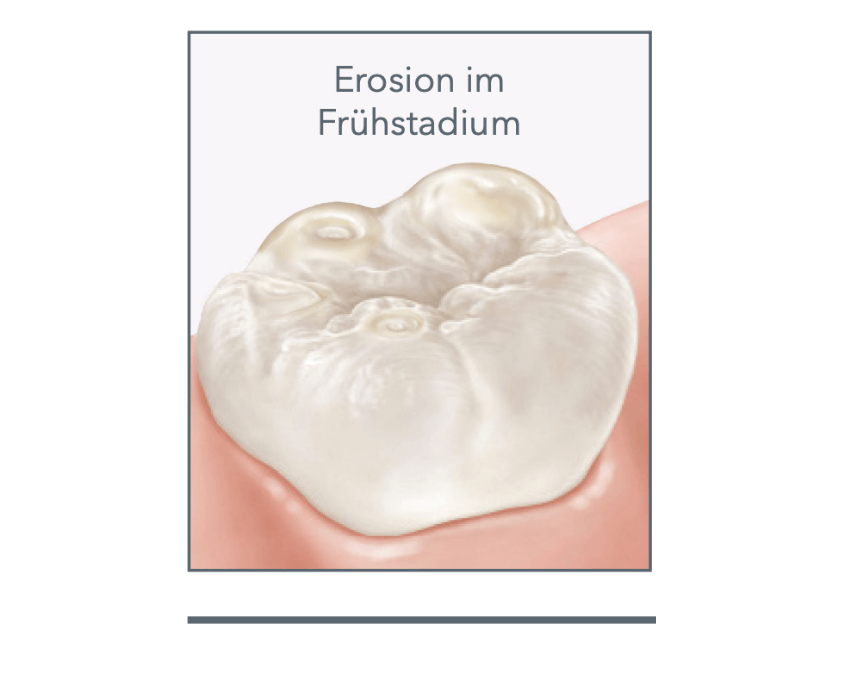 Weiße Zähne