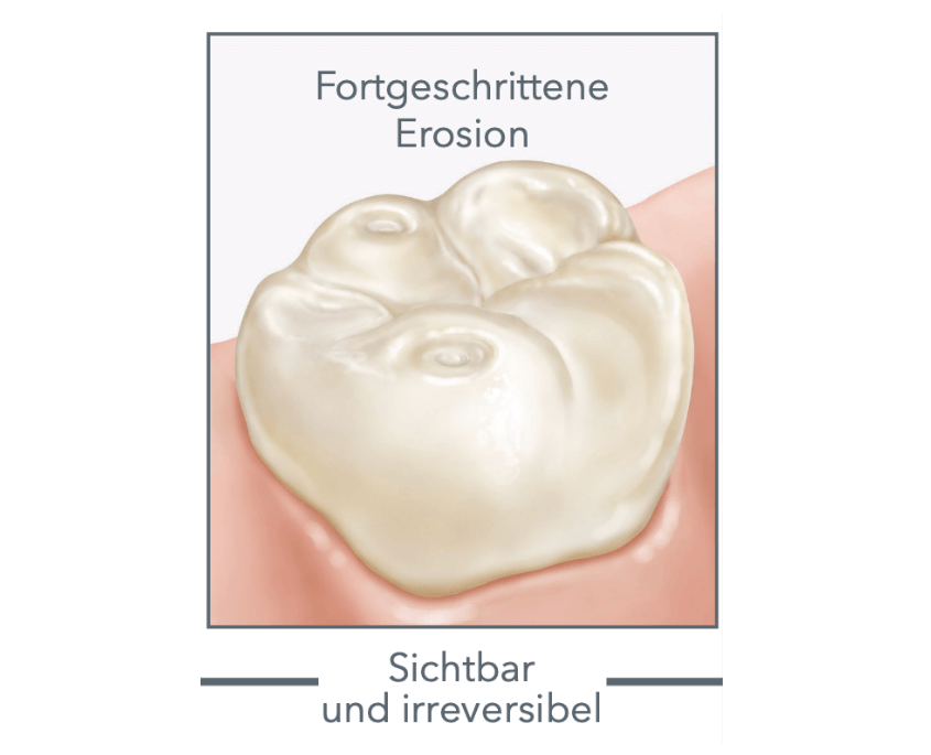 Weiße Zähne
