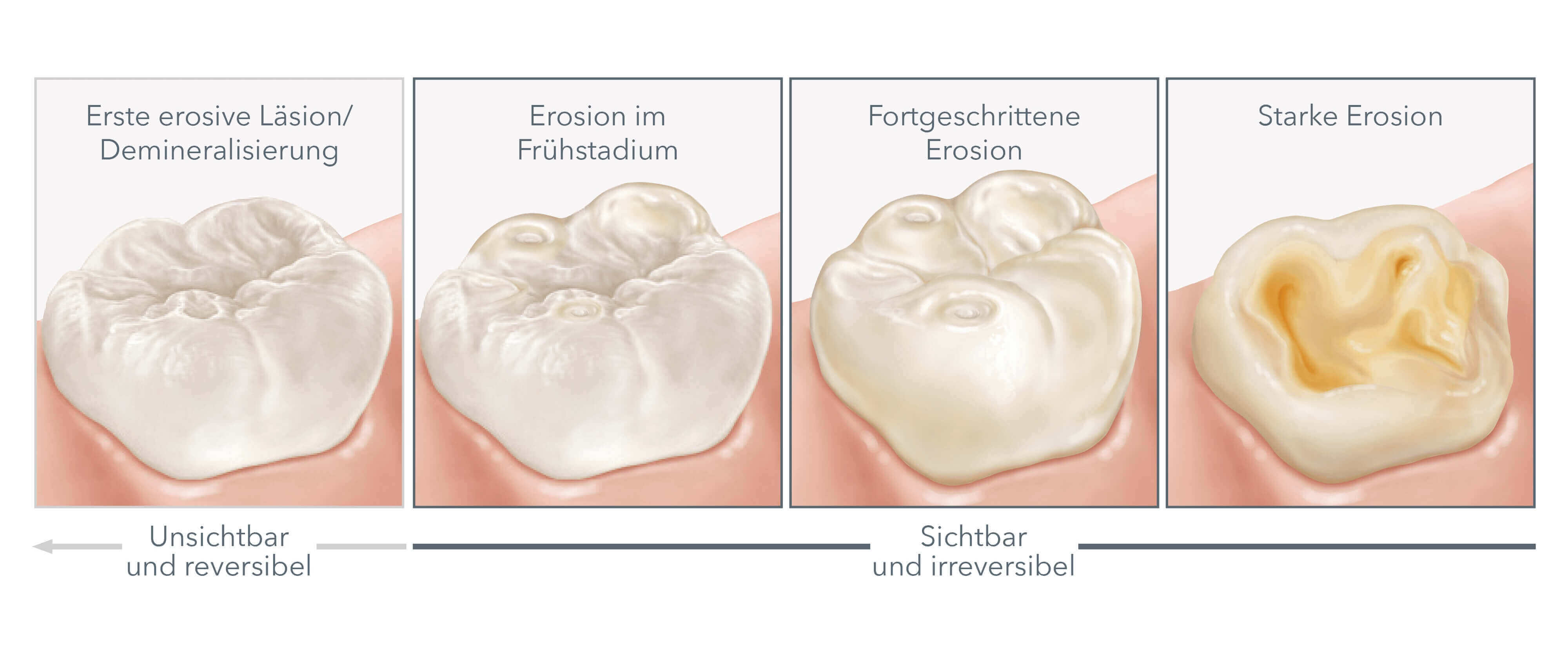 Entstehung, Ursachen und Symptome
