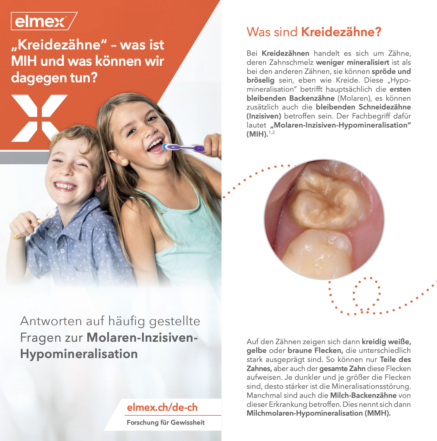 PDF zu MIH: „Kreidezähne“