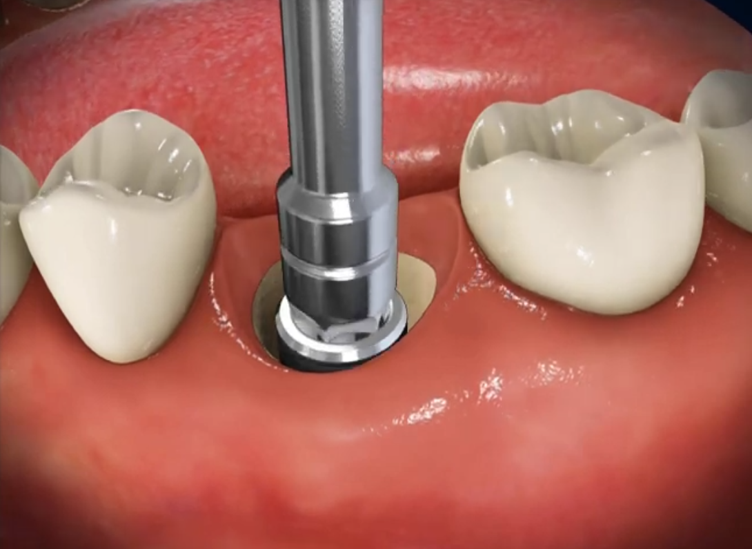 Wortwolke in Form einer Zahnpastatube mit Begriffen wie Kaliumnitrat, Anti-Gingivitis und Karies-Schutz.