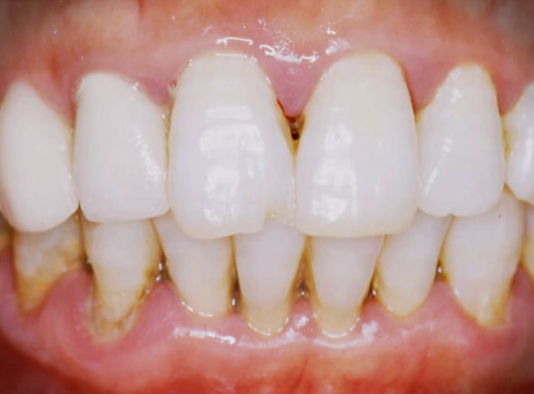 Wortwolke in Form einer Zahnpastatube mit Begriffen wie Kaliumnitrat, Anti-Gingivitis und Karies-Schutz.